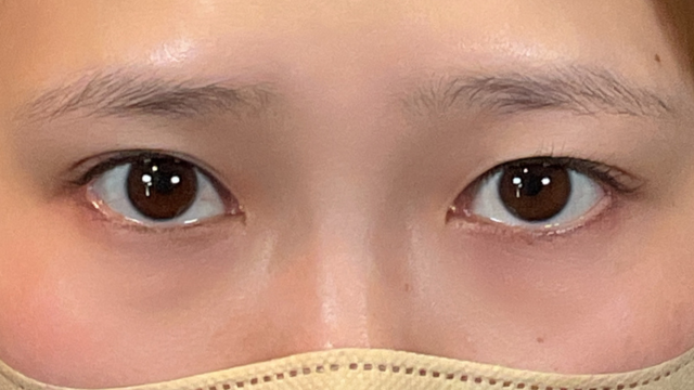 手术前的状态 其一