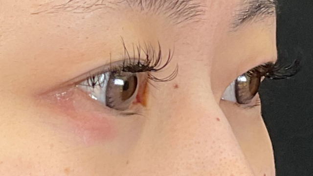 手术前的状态 其一