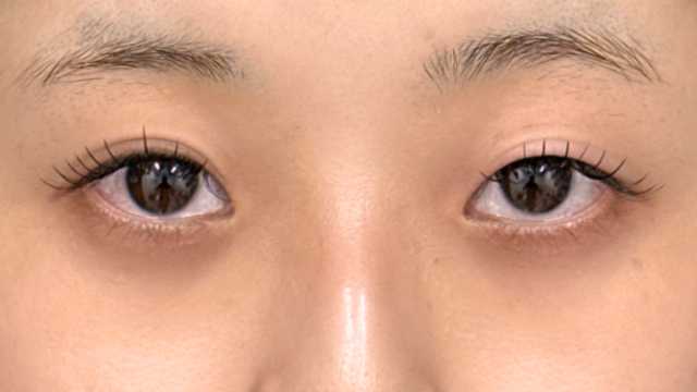 Preoperative Condition Part 1