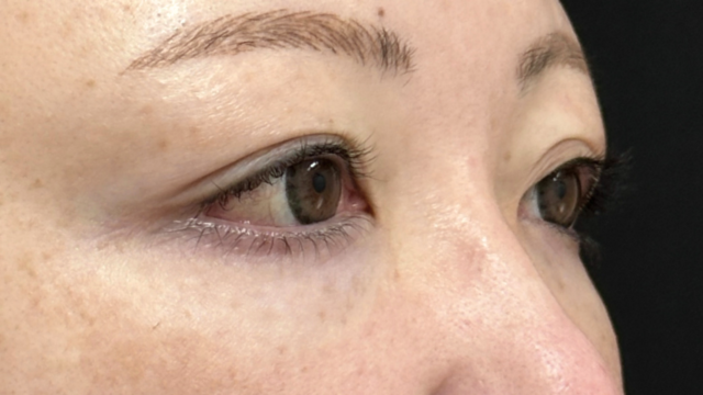 Preoperative Condition Part 1