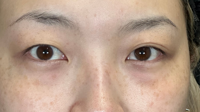 手术前的状态 其一