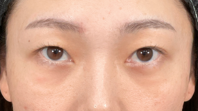 手术前的状态 其一