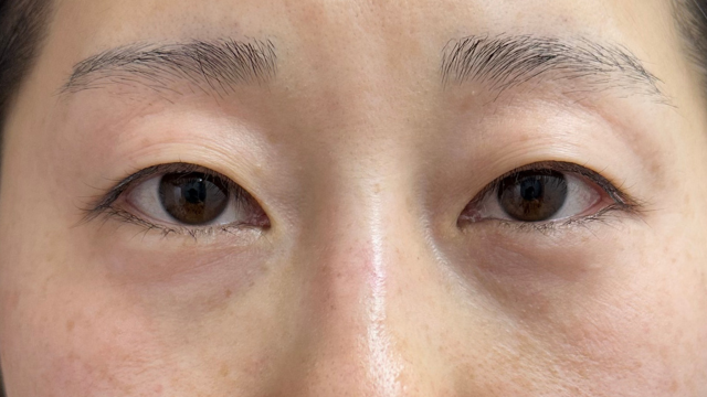 手术前的状态 其一