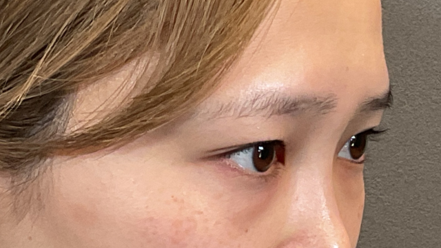 手术前的状态 其一