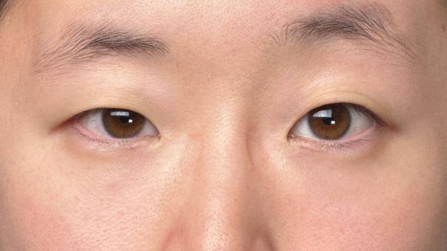 Preoperative Condition Part 1