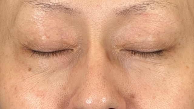 Preoperative Condition Part 1