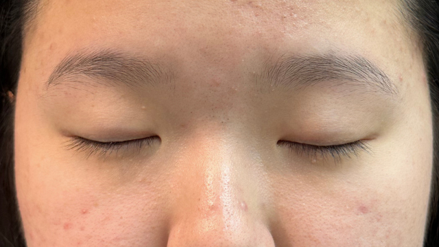 手术前的状态 其一