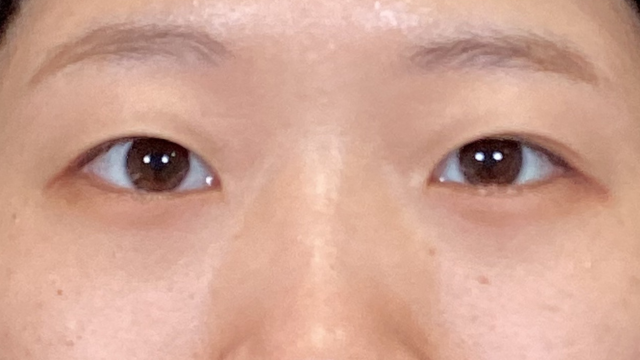 手术前的状态 其一