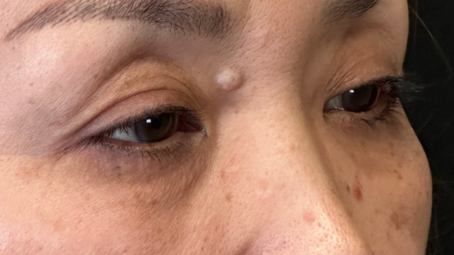 Preoperative Condition Part 1