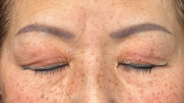 Preoperative Condition Part 1