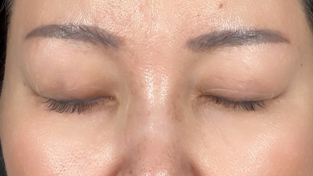 Preoperative Condition Part 1