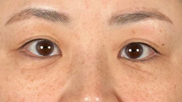 手术前的状态 其一