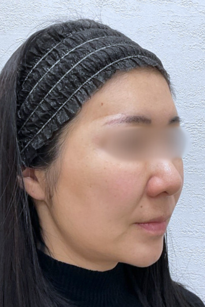 手术前的状态 其一