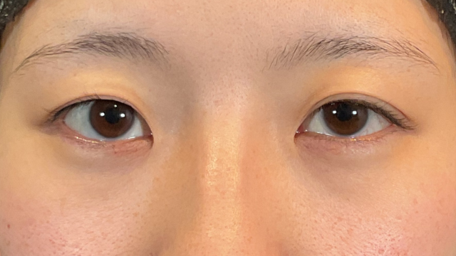 手术前的状态 其一