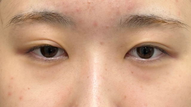 Preoperative Condition Part 1