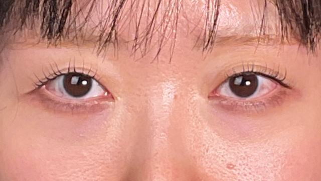 手术前的状态 其一