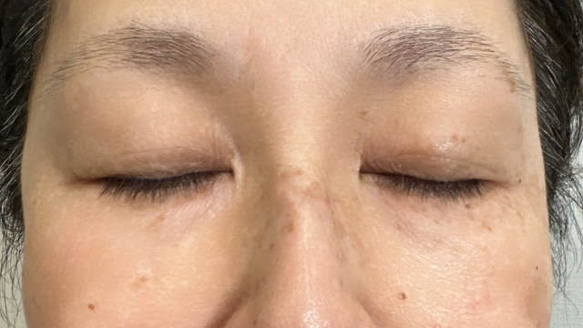 手术前的状态 其一