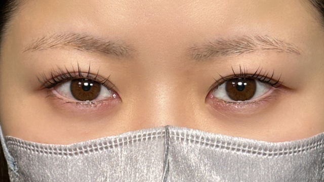 手术前的状态 其一