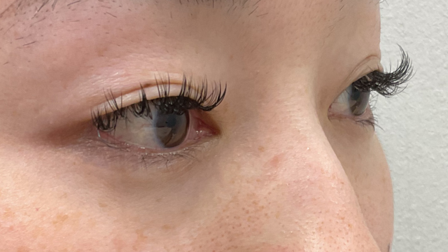 手术前的状态 其一