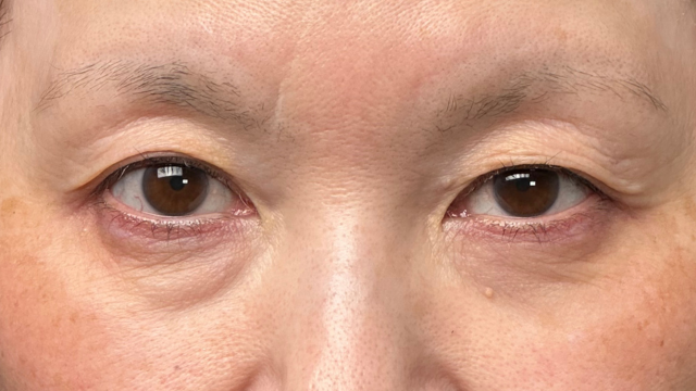 手术前的状态 其一