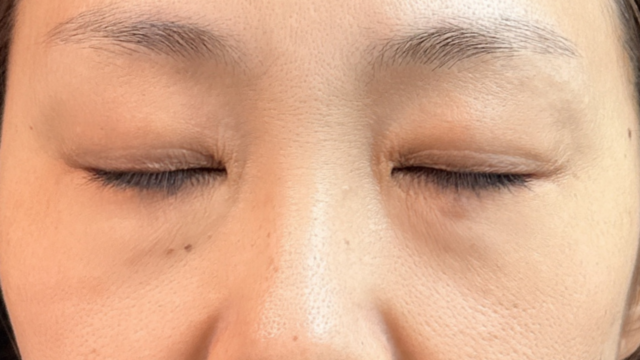 Preoperative Condition Part 1