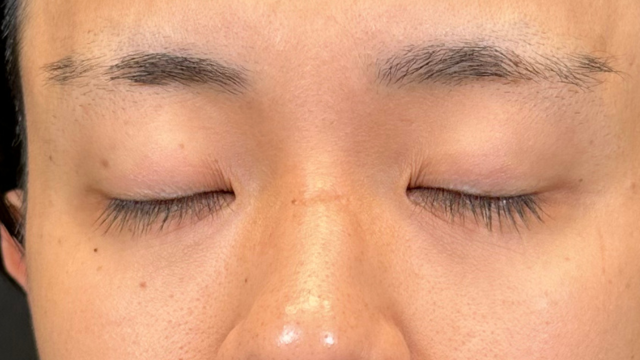 手术前的状态 其一