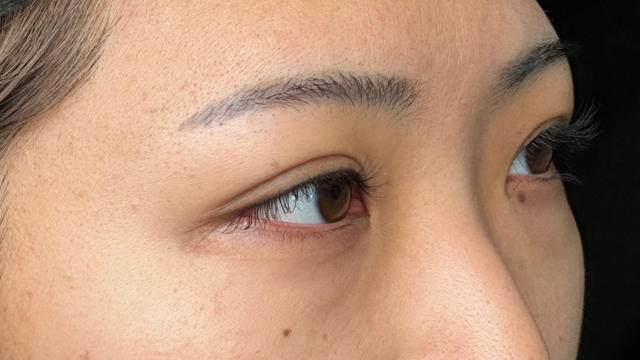 Preoperative Condition Part 1