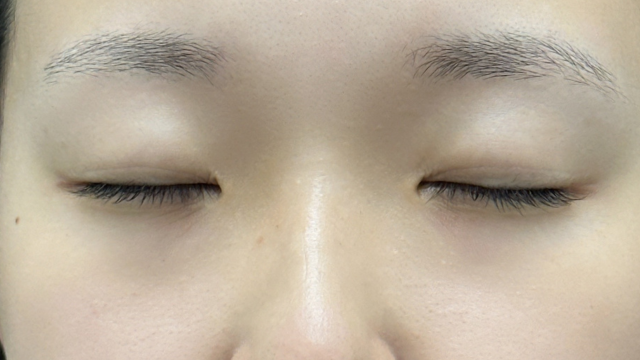 手术前的状态 其一