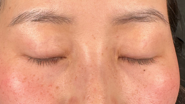 手术前的状态 其一