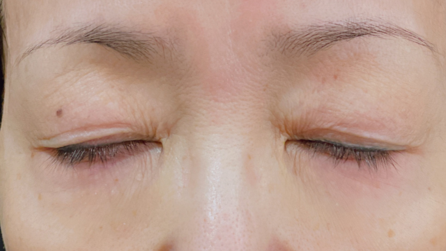 Preoperative Condition Part 1