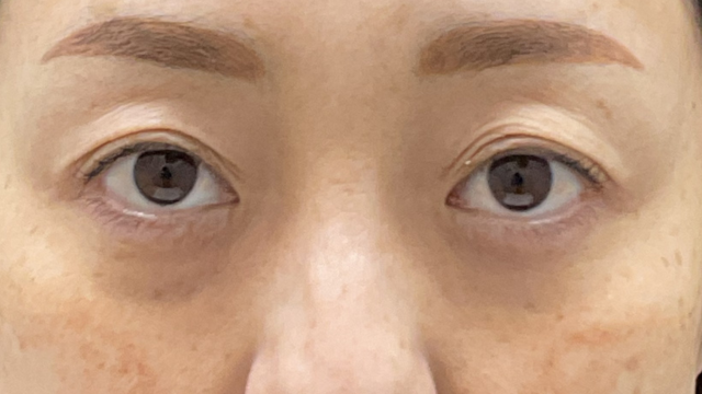 Preoperative Condition Part 1