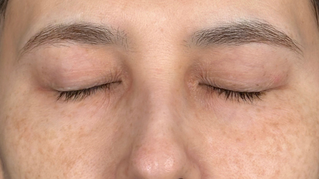 手术前的状态 其一