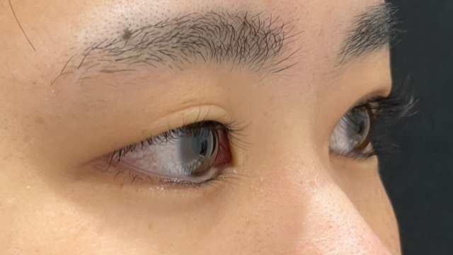 Preoperative Condition Part 1