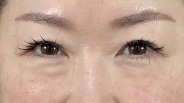 Preoperative Condition Part 1