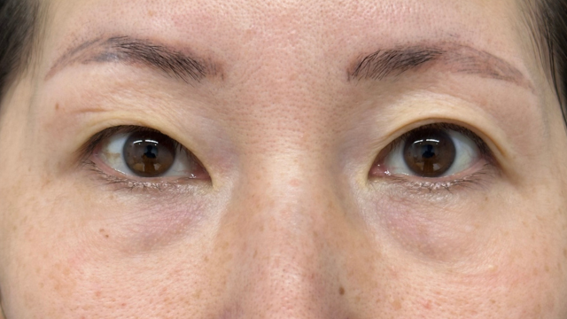 手术前的状态 其一