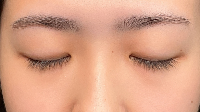 手术前的状态 其一