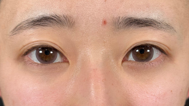 手术前的状态 其一