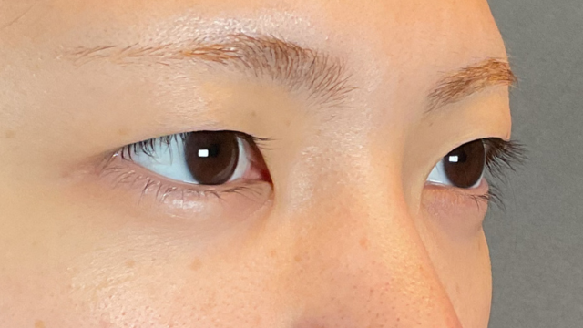 手术前的状态 其一