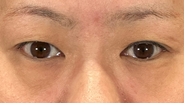 Preoperative Condition Part 1