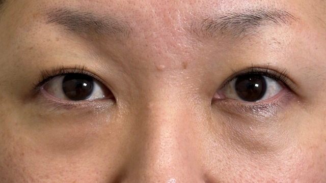 Preoperative Condition Part 1