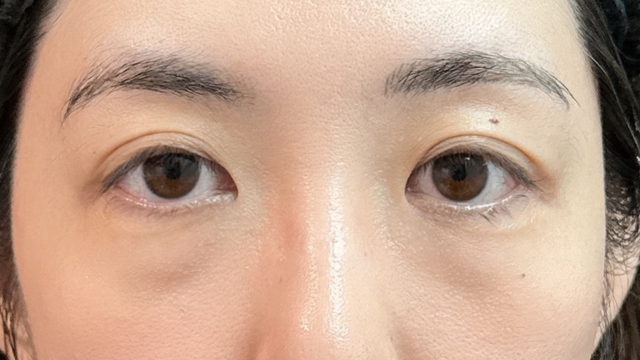 手术前的状态 其一