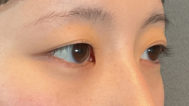 手术前的状态 其一