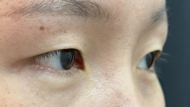 Preoperative Condition Part 1