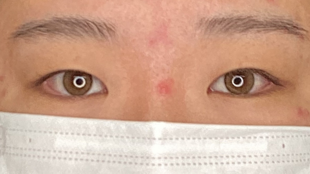 手术前的状态 其一