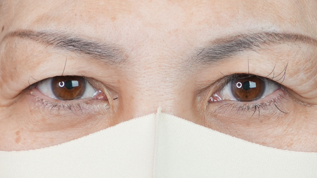 手术前的状态 其一