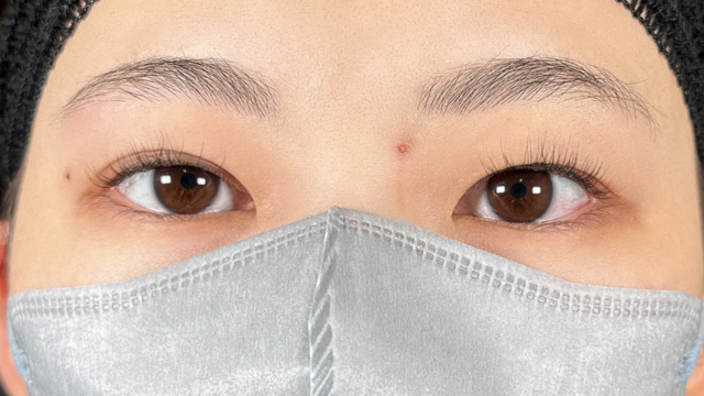 手术前的状态 其一