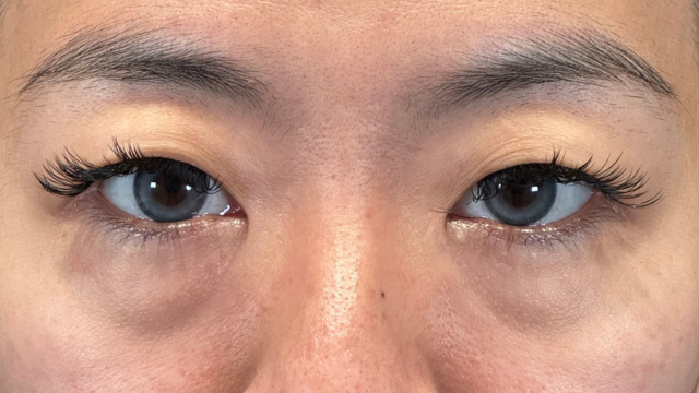 Preoperative Condition Part 1