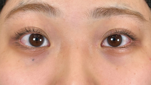 Preoperative Condition Part 1