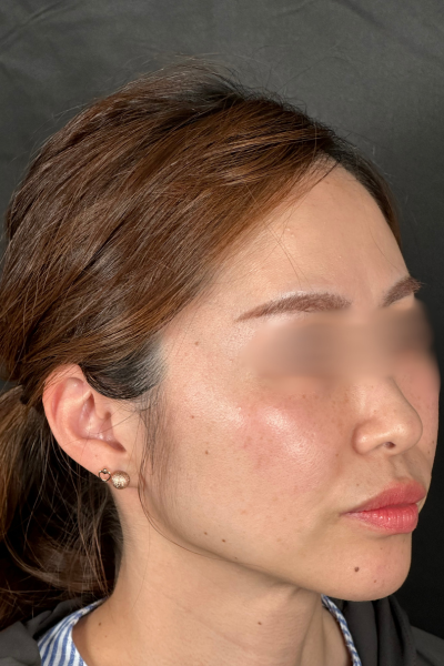 手术前的状态 其一