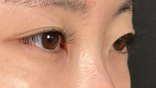 Preoperative Condition Part 1